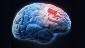 اخیرا محققان یک ایمپلنت مغزی برای معلولان طراحی کرده‌اند که آن‌ها هم بتوانند از وسایل دیجیتالی استفاده کنند.