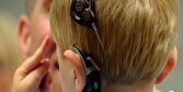 ثبت رکورد کاشت حلزون شنوایی در کشور/ بیمه‌ها پول پروتز حلزون شنوایی را نمی‌دهند