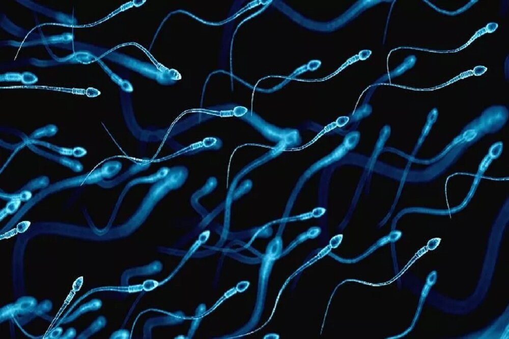 وبینار روش‌های جداسازی اسپرم جهت استفاده در درمان ناباروری