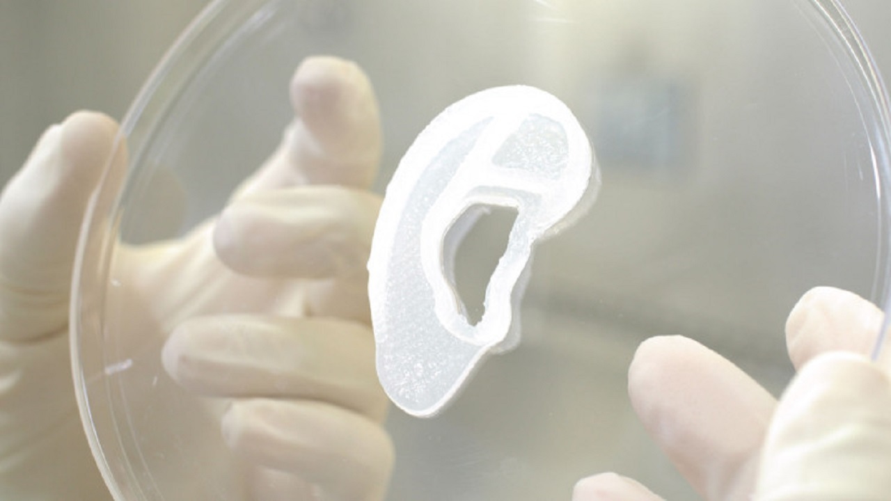 برای اولین بار در جهان، گوش انسان که با استفاده از پرینت سه بعدی ساخته شده بود برای یک زن پیوند زده شد.