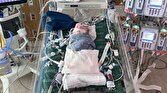 نجات  جان یک نوزاد با پیوند بافت زنده قلب